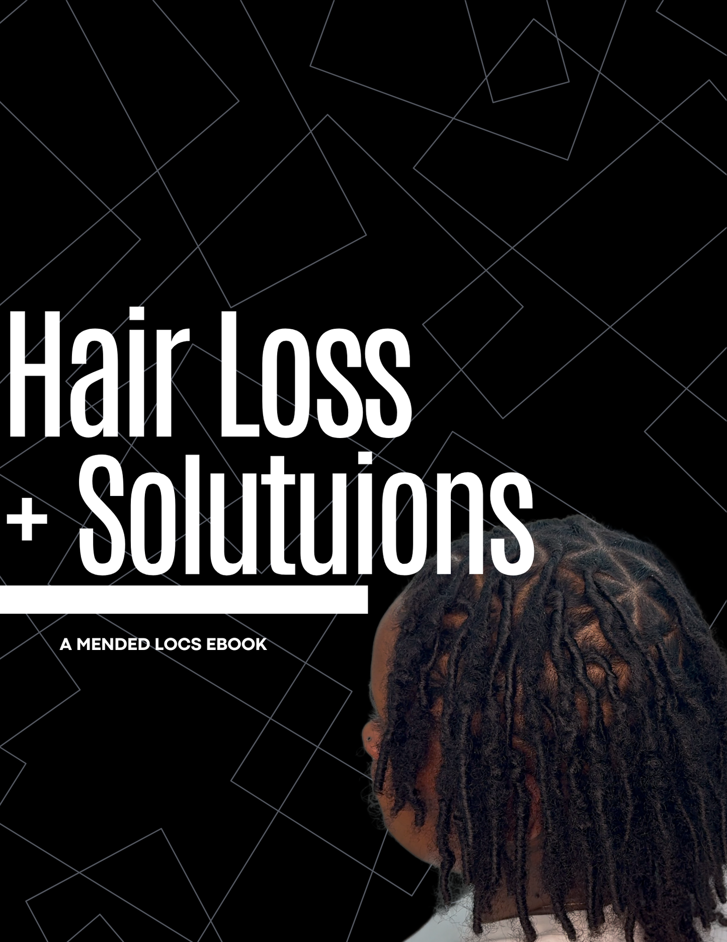 "Hairloss and Solutions"